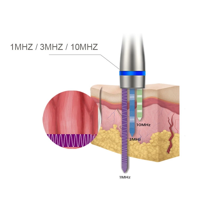 LDM Noblesse 10MHz Ultrason Tedavisi 3'ü 1 Arada Ultrasonik Kırışıklık Güzellik Zayıflama Cihazı Yüz Bakım Aleti Kaldırma